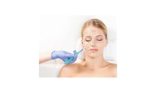 Hair Transplant in Turkey: Cost, Clinics & What to Expect (2026)